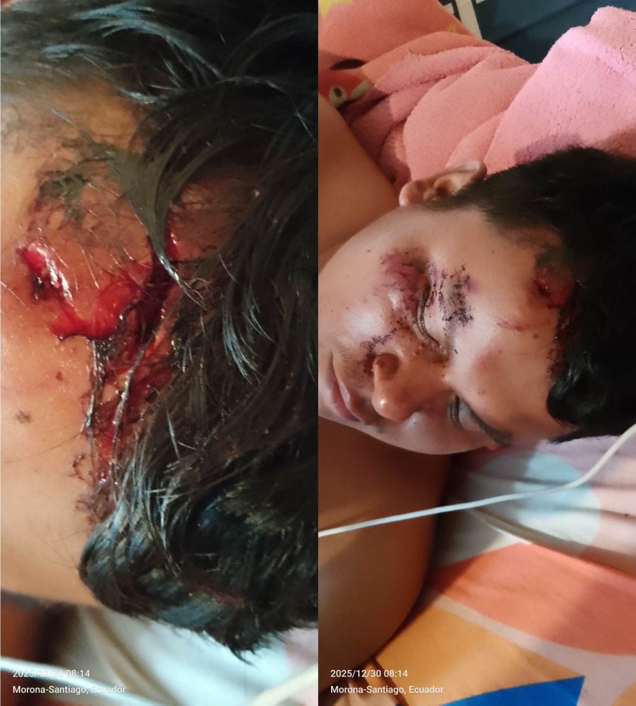 Presunto atentado contra el ex presidente de la FICSH, Luis Senkuan