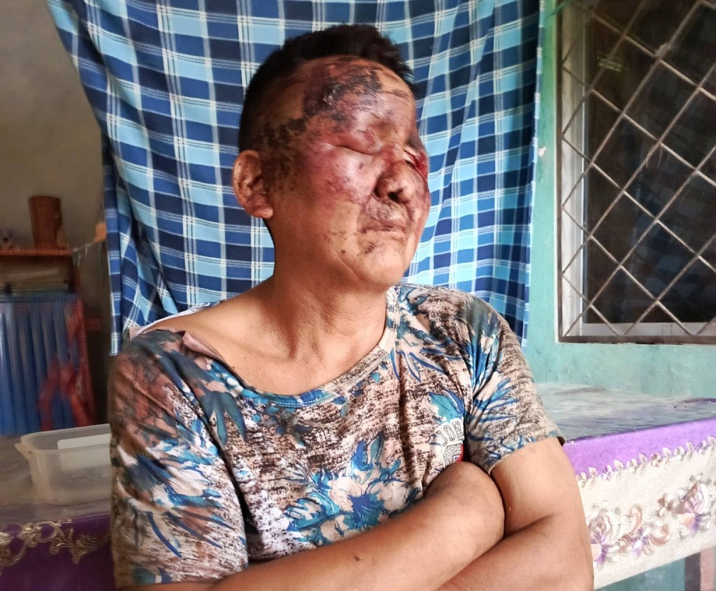 Sevilla Don Bosco: agresión a ciudadano con discapacidad causa&nbsp;conmoción