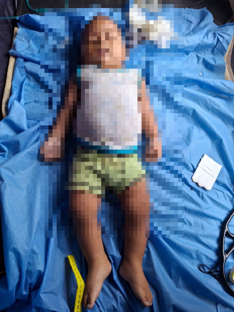 Muerte de bebé con tosferina en Taisha en medio de alertas por crisis en el sistema de salud