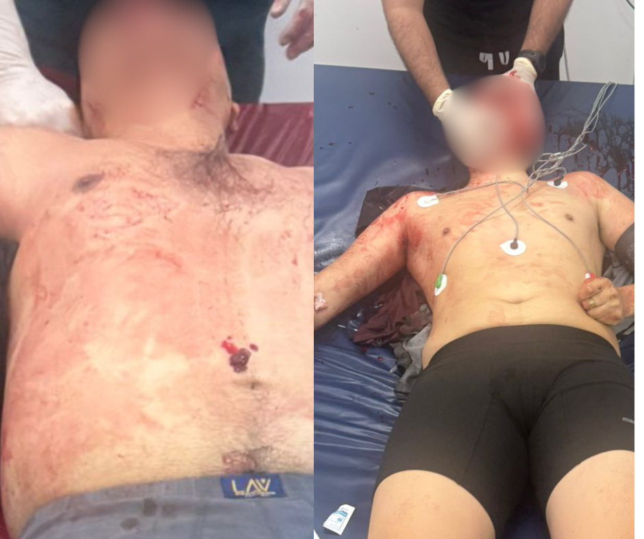 Manabí: Policías resultaron heridos por disparo de arma de fuego