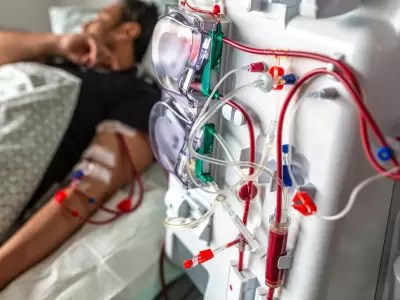 3.850 Pacientes renales en alerta por riesgo de suspensión de diálisis por deudas del Estado